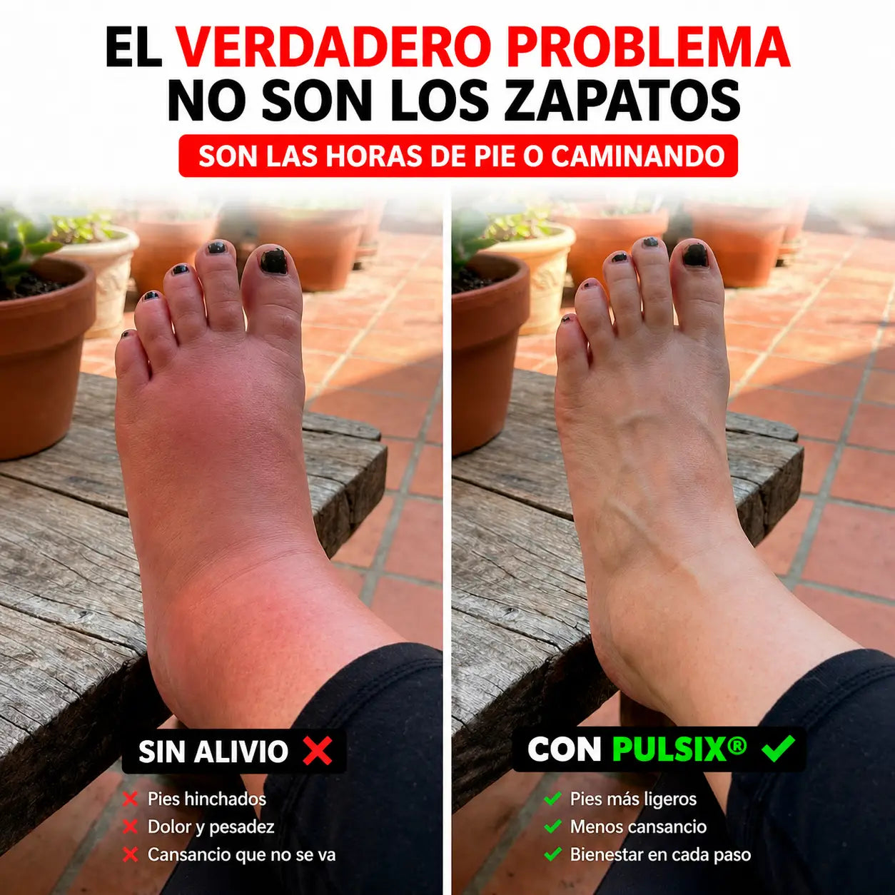 Pulsix® Sandalias de masaje por Acupresion para descansar los pies.